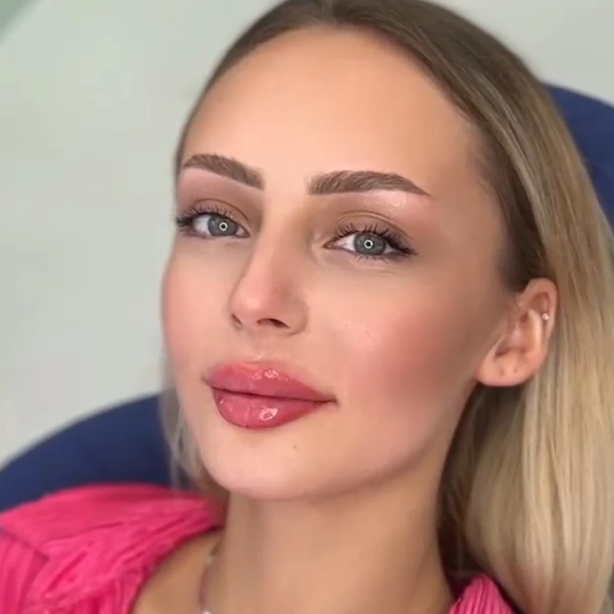 Volumizare bune 0,5 ml AH feed 38